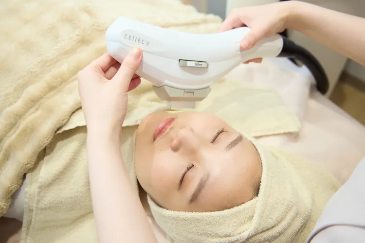 IPL(光治療)